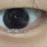[댓글부탁해] <b>내</b> <b>눈</b>에 쌍수 하면