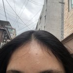 [댓글부탁해] 애들아 나 피부 더 안 좋아진거 같아??