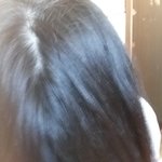 야..나 <b>탈모</b> 초기 같아? 진짜 급해ㅜㅜ