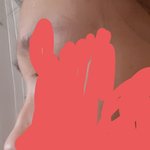 나처럼 입술 툭튀인 사람 있음?