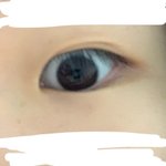 [드루와] 쌍커풀 <b>다</b><b>담주</b> 재수술 해말아