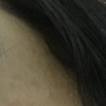 약혐) 이거 여드름 <b>흉터</b> 맞지