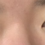 못생긴 코 <b>자랑대회</b>