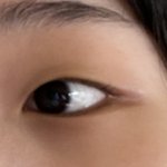 <b>이런</b> <b>눈</b>은 어케 해야됨..??ㅠㅠ