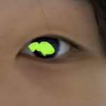 <b>이런</b> <b>눈</b>은 어케 해야돼??