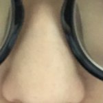 못생긴코 대회 <b>안경</b>끼고 찍은애들은 다시해야함