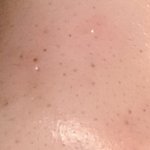(약혐)내 역대급 블랙<b>헤드</b> 변화 보실?