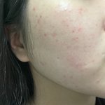 [댓글부탁해] 컨실러 없이 <b>커버</b> <b>가능</b>할까ㅠㅠ?