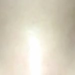 나 <b>쌍수</b>했는데 <b>라인</b> 어케 될거같음
