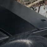 [댓글부탁해] 얘들아 이거 <b>탈모야</b>???