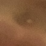 [댓글부탁해] <b>미방</b>없음 ㅇㅎ주의)) 여드름 패치에 이렇게 올라오면