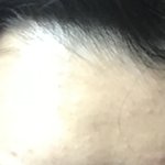내 <b>이마</b>에서 축구장하실분~