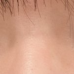 [댓글부탁해] 나 쌍수 어울릴까
