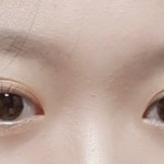 <b>미간</b> 넓음?