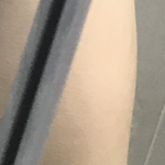 나 팔꿈치 <b>뾰족</b>함