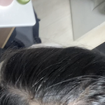 나 <b>탈모</b>같아??