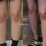 다리 알빼는 꿀팁!! (수능끝난 고3들 다 들어와봐)