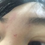 망했다 눈썹깎다가 피부에 상처 <b>조카남</b>