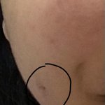 [ㅈㄱㄴ] 보조개 만들고 후기 들고올게...