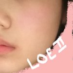 [드루와] <b>홍조</b> 생겼는데