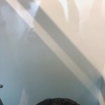 급해..<b>탈모</b>인지 좀 봐줘 ㅠㅠㅠ
