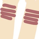 [댓글부탁해] 허벅지에 회초리<b>자국</b> 지우는방법 ㅠ