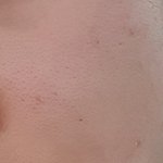 [댓글부탁해] 피부때메 공부안된다하면 욕할꺼임?