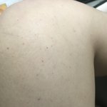 [댓글부탁해] 나 다리가 이상해