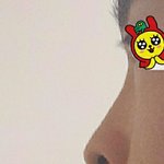 <b>코</b> ㅈ  ㄴ개못생기고 심각하다<b>vs</b>아니다 추반