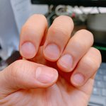 [이것좀봐줘] 못난이<b>손톱</b>, 사람<b>손톱</b> 됐어요