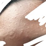 <b>좁쌀</b> 남드름 어떡해? 도와줘 판녀들~