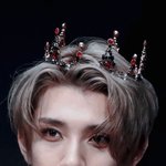 [댓글부탁해] 이런 <b>쌍</b>커풀은 수술으로 안되지?