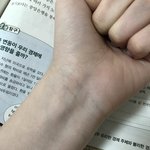 애들아 내 혈관 푸른색인초록색임??