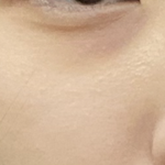 다크<b>서클</b> 어떻게 없애