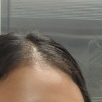 [알려줘] 피부 하얘지는 법 아는 사람?