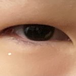 [댓글부탁해] 눈 성형 진짜 하고싶어.. 봐줘..