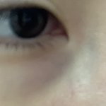 나 다크<b>써클</b> ㄹㅈㄷ임