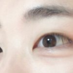[드루와] 쌍수 추반 해주라 그리고 한다면 시기는 언제가 좋을깡...