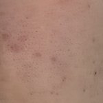이거 다 블랙<b>헤드</b>임...?