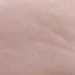 나 이마자국같은거 잘 나는데 쌍수 절개 하면 <b>흉터</b>
