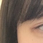 나 중3때 <b>쌍수</b>했는데 궁금한거 있어?