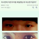 남자 <b>쌍수</b> 레전드