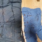 [이것좀봐줘] 6세아이가 태권도<b>하원차량</b>에서 10세아이가 휘두른 가위에...