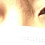 딱보기에 내가 <b>미간</b>이 넓은 편이야?