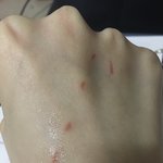 이걸로 피부과 가도돼???
