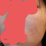 피부<b>이</b>정도면 <b>화장</b>으로 다 커버ㄱㄴ하냐