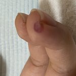 내손가락 왜이러는지 아는 사람ㅈㅂ