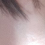 [ㅈㄱㄴ] 얘들아 미간넓이 이정도면 앞트임 해도 ㄱㅊ??