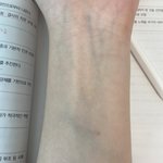 내 팔 <b>핏줄</b> 봐봐 ㅠㅠㅠ