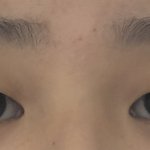 [댓글부탁해] 쌍수 할까말까 ㅠㅠㅠ 제발봐주삼